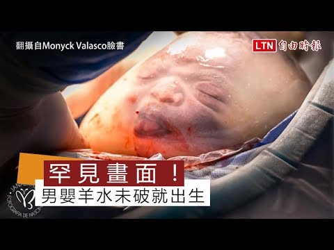 羊水未破就出生男婴“包膜照”震惊全球(视频)