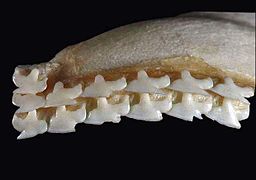 Upper teeth