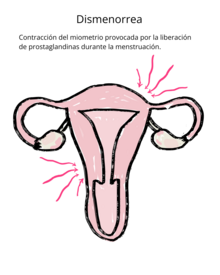 Contracción del miometrio