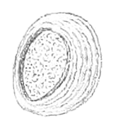 Inner side of an operculum