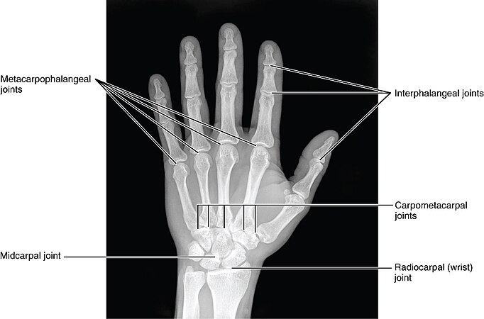 X-ray