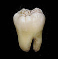 Dente molar