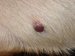 Hemangiosarcoma of skin.JPG