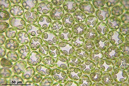 Pedinophyllum interruptum, laminacellen van een levermos met chloroplasten (groen, donkerder) tegen de celwand (licht), en bolle tot spoelvormige olielichaampjes (licht) in de laminacellen, celhoeken verdikt (collenchymatisch)