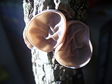 Ausiagrybis (Auricularia sp.)