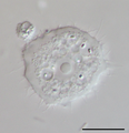 Acanthamoeba sp. (Discosea)