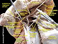 Common carotid artery