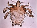 Crab louse