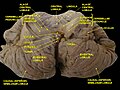 Cerebellum. Inferior surface.