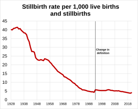 Stillbirth rate in England and Wales