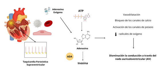 La imagen representa el mecanismo de acción de la adenosina exógena en el tratamiento de la taquicardia paroxística supraventricular (TPSV). La adenosina es una molécula que se encuentra de forma natural en nuestro organismo, pero también puede ser administrada como medicamento. En esta imagen, se representa como una molécula simple y se indica que es exógena, es decir, que proviene de una fuente externa al cuerpo. El ATP (trifosfato de adenosina), por otro lado, es una molécula que proporciona energía a las células. En la imagen se muestra su estructura molecular, más compleja que la de la adenosina. Cuando se administra adenosina exógena: Se une a los receptores de adenosina en las células del corazón. Esto desencadena una serie de eventos que conducen a la disminución de la conducción eléctrica a través del nodo auriculoventricular (NAV). Bloquea los canales de calcio: Al bloquear estos canales, se reduce la entrada de calcio a las células del corazón, lo que disminuye la fuerza y la frecuencia de las contracciones cardíacas. Activa los canales de potasio: Al activar estos canales, se aumenta la salida de potasio de las células del corazón, lo que también contribuye a disminuir la excitabilidad y la contractilidad del músculo cardíaco. Aumenta la producción de radicales de oxígeno: Aunque los radicales de oxígeno son generalmente dañinos para las células, en este caso, su producción tiene un efecto beneficioso al contribuir a la disminución de la conducción a través del NAV. Todos estos efectos combinados tienen como resultado la disminución de la conducción eléctrica a través del nodo auriculoventricular (NAV). El NAV es una estructura del corazón que controla la frecuencia cardíaca y la coordinación de las contracciones de las aurículas y los ventrículos. Al disminuir la conducción a través del NAV, la adenosina puede interrumpir los circuitos eléctricos anormales que causan la taquicardia paroxística supraventricular y restaurar un ritmo cardíaco normal. La enzima ADA (adenosina desaminasa) es responsable de descomponer la adenosina en inosina. Esta es la razón por la cual el efecto de la adenosina es de corta duración, ya que rápidamente es metabolizada por esta enzima.