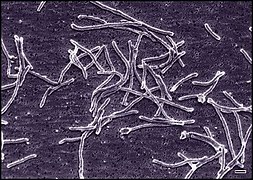 Thermus aquaticus (Deinococcus-Thermus)