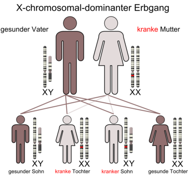 X-chromosomal durch die Mutter vererbtes, dominantes Merkmal. Söhne und Töchter prägen das Merkmal in jeweils 50 % der Fälle aus.