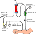 Esquema representativo do circuito de hemodiálise.