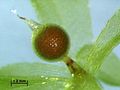 Kleistokarper Sporophyt (Sporenkapsel) von Physcomitrella patens