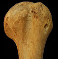 Left humerus head