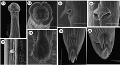 Torrestrongylus tetradorsalis (een rondworm)