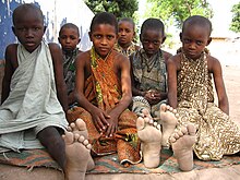 Talibes in Vélingara, Kolda Region, Senegal in 2007