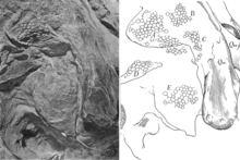 Photograph and interpretive drawing of a region at the back of the skull showing bones and skin impressions