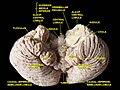 Cerebellum. Inferior surface.