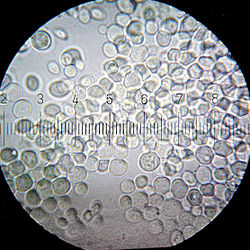 Saccharomyces cerevisiae