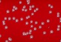 Corynebacterium ulcerans