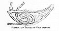 Sternum & Trachea