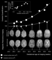 Neural development