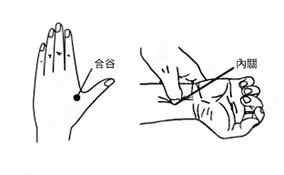 Acupressure