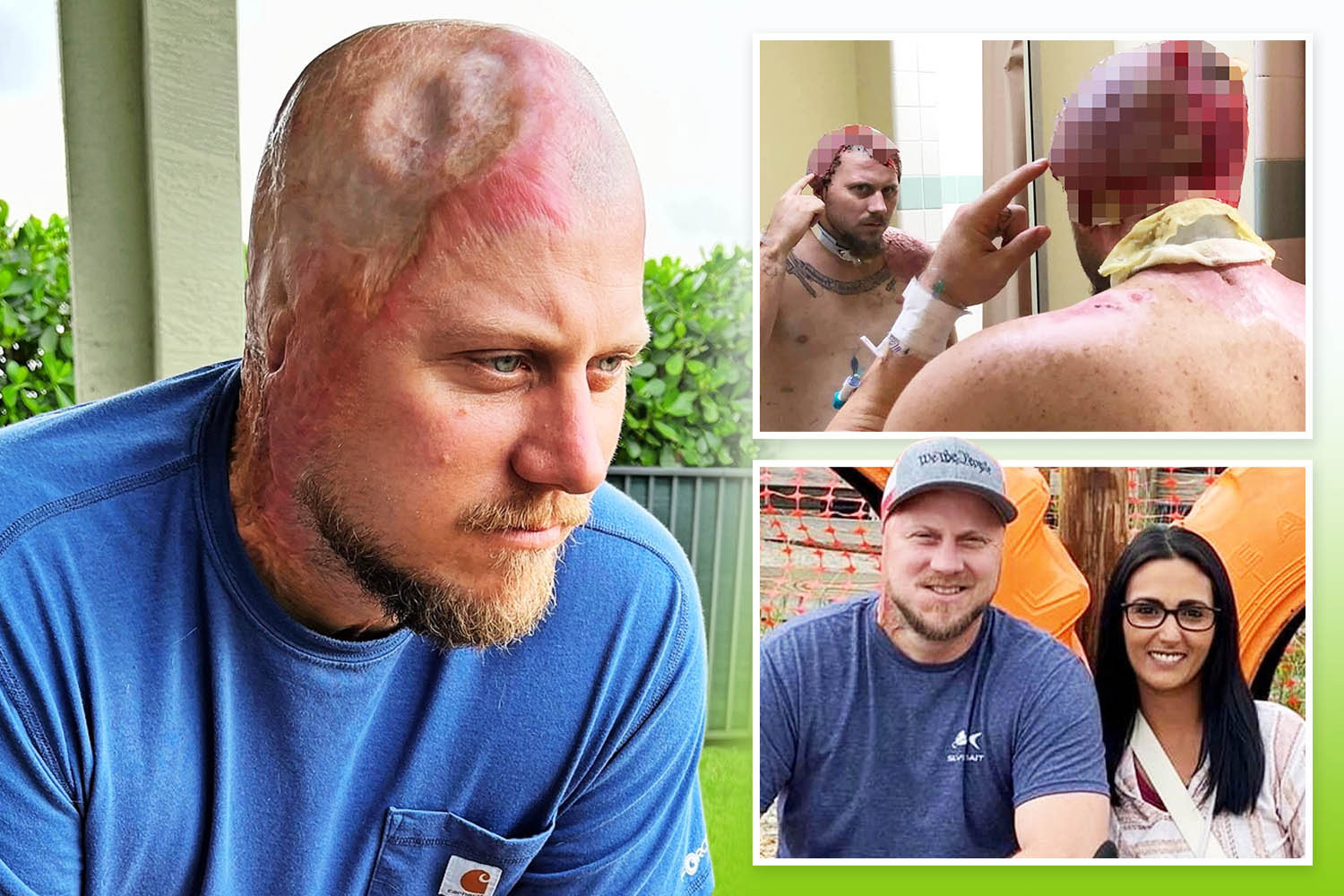 I 'died' twice after being electrocuted  - 4,160 volts shot through my brain