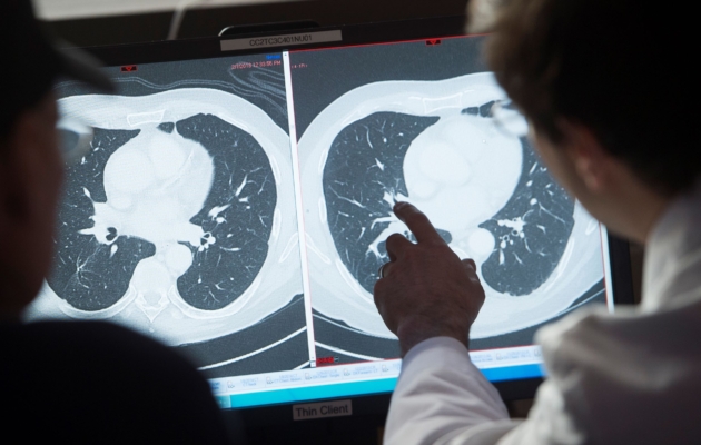 An investigator at the National Cancer Institute in immunotherapy for HPV+ cancers, shows a patient the difference between his CT scan showing cancerous tumors (R) and a clean scan after treatment (L), at the National Institutes of Health (NIH) in Bethesda, Md., on Feb. 8, 2018. (Saul Loeb/AFP via Getty Images)