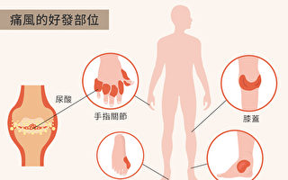 當心痛風不控制 步上洗腎末路