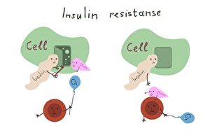 糖尿病脂肪肝禍首是胰島素抵抗！這些症狀勿輕忽