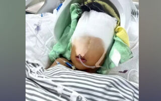 7歲男童被單身漢砸致顱骨粉碎性骨折 住進ICU