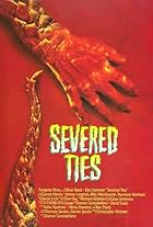 Severed Ties