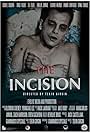 The Incision (2014)