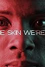 The Skin We're In (2017)