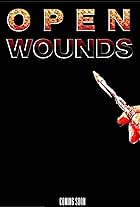 Open Wounds