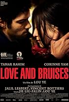 Love and Bruises